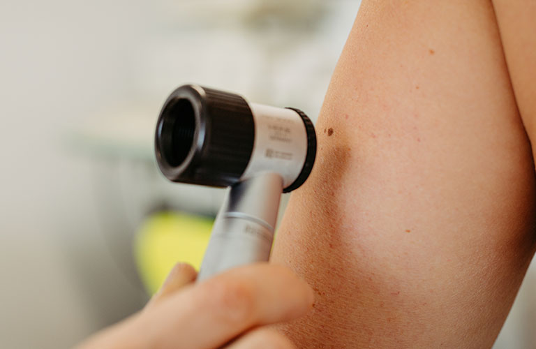 Dermatoskop Untersuchung Detail